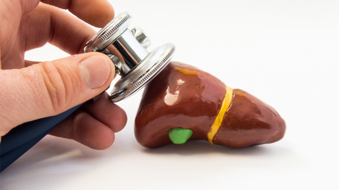 lipid profile screening