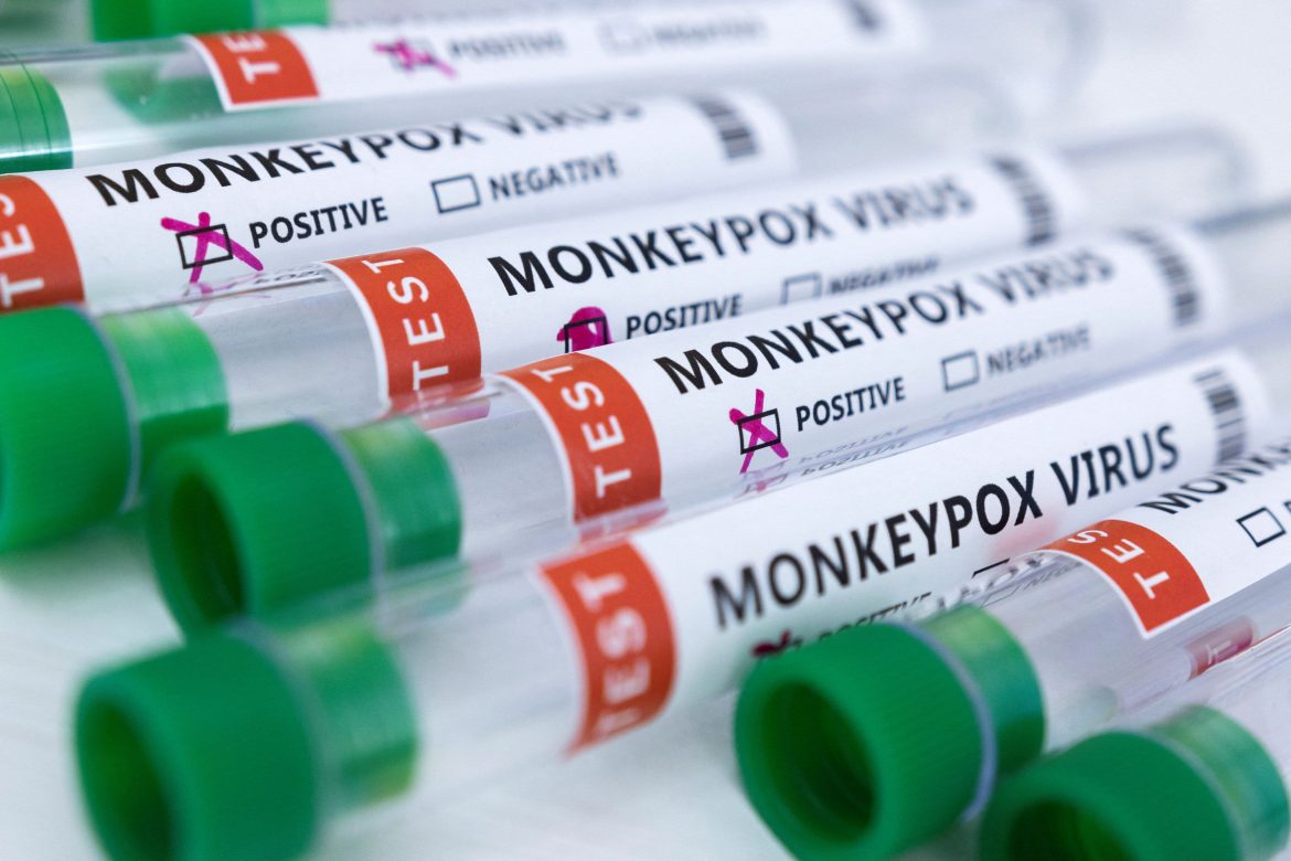 monkeypox