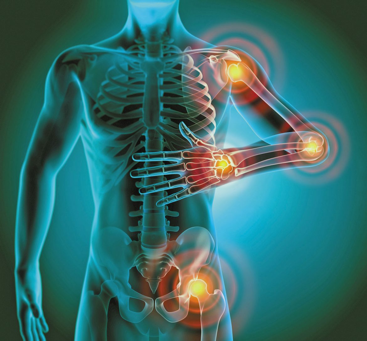 vitamin-d-deficiency-associated-with-chronic-inflammation-study