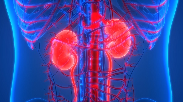 Guard Your Kidneys: 5 Lifestyle Mistakes That Can Lead to Renal Cancer and How to Avoid Them