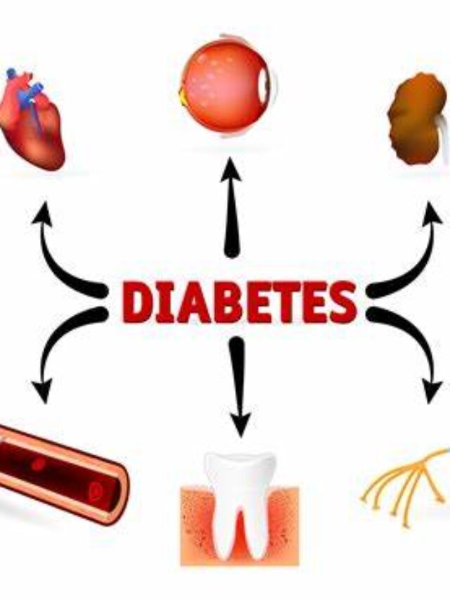 Beyond Blood Sugar: Five Diseases Diabetics Should Watch Out For – Watch Video for Essential Tips