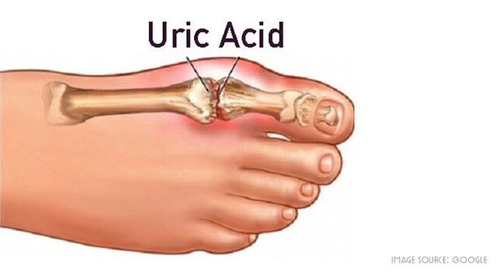 Watch Video: Understanding the Dangers of High Uric Acid Levels and How to Manage Them Effectively!