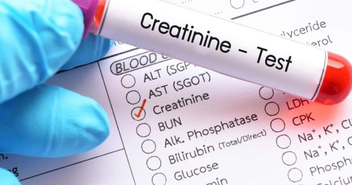 Easy Ways to Reduce Creatinine Levels for Healthy Kidneys