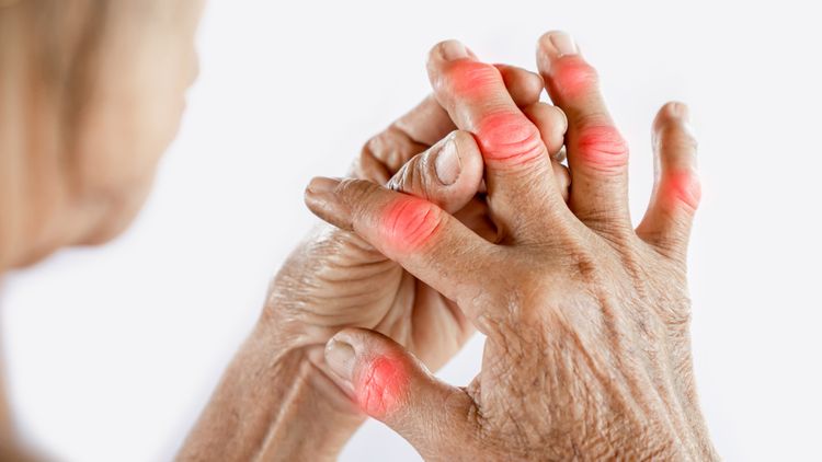 Empower Your RA Management: 10 Natural Remedies to Alleviate Rheumatoid Arthritis Symptoms