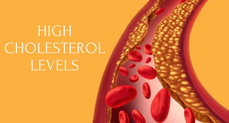 Can High Cholesterol Alone Give You a Heart Attack? Here’s Good News