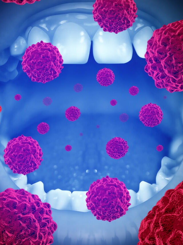 Silent Threat: 5 Ways to Fight Oral Cancer & the Warning Signs You Shouldn’t Ignore!