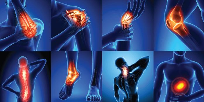 Unlock the Secrets to Pain-Free Joints: Watch Our Video for Expert Tips and Solutions