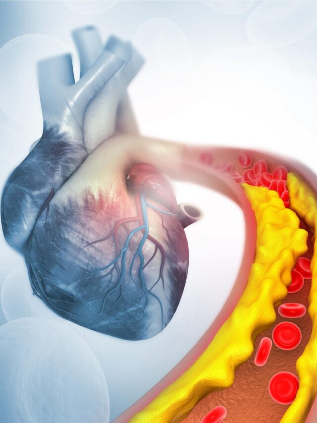 7 Essential Dietary Changes to Combat High Cholesterol and Strengthen Your Heart