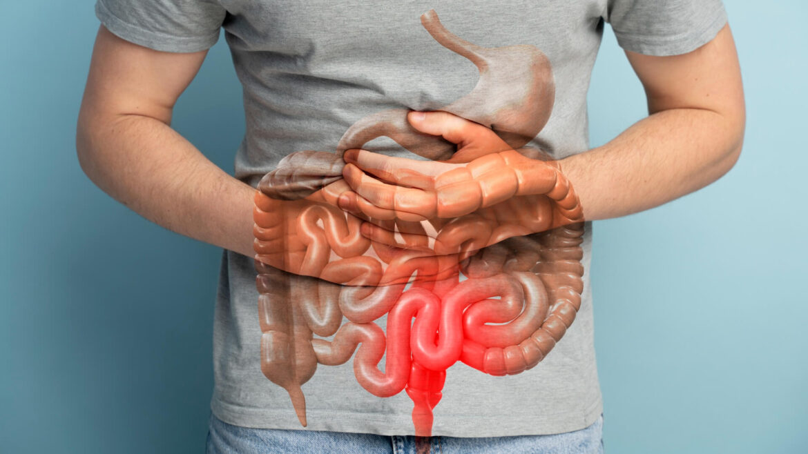 UNDERSTAND WHY A DIETARY APPROACH IS BETTER THAN LAXATIVES IN TREATING CONSTIPATION AND HERNIA