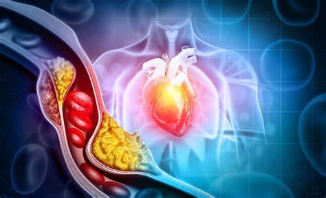 Good Cholesterol Goldmine: 6 Daily Habits to Boost HDL and Shield Your Heart