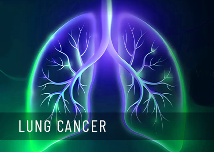 Beyond the Cough: Unveiling the Hidden Signs of Lung Cancer You Shouldn't Ignore