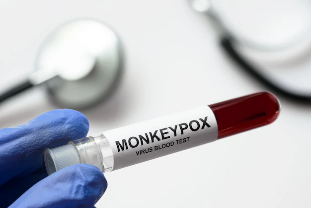 Video: Monkeypox vs. Smallpox vs. COVID-19—Understanding the Key Differences in These Viral Threats