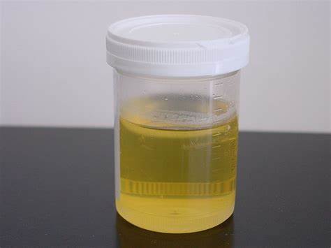 Watch the Video: What Foamy Urine Really Means and When to Seek Help