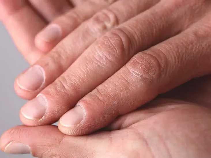 Explore Common Fingernail Abnormalities and Their Health Implications