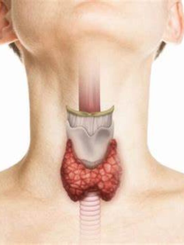 Master Your Thyroid Health: 5 Essential Daily Habits to Manage Hypothyroidism Naturally