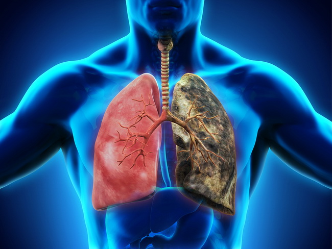 Watch This Video to Uncover the Hidden Dangers of Lung Disease and How to Protect Yourself!