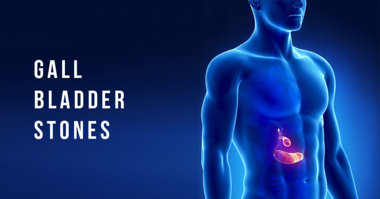 "Gallstone Prevention: Discover the 5 Foods to Avoid for a Healthier Digestive System"