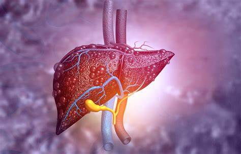 "Watch Video: Early Signs, Causes, and Prevention of Fatty Liver Disease You Shouldn’t Ignore"