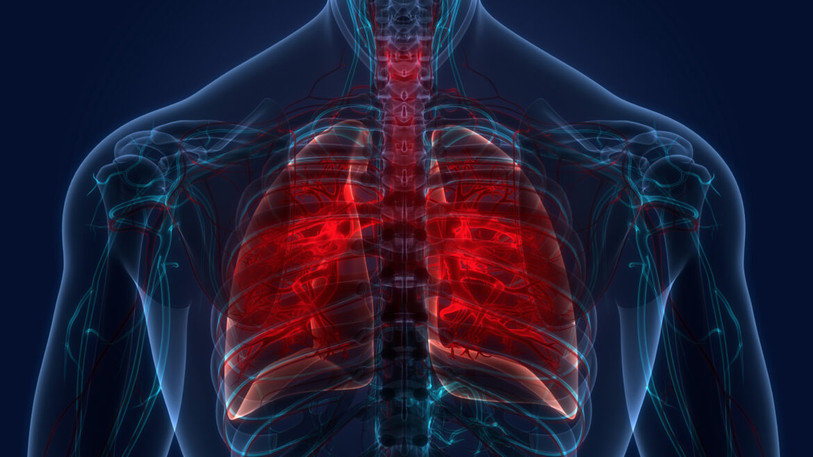 Tuberculosis Surpasses COVID as the Most Infectious Disease: WHO Report Highlights Ongoing Challenges