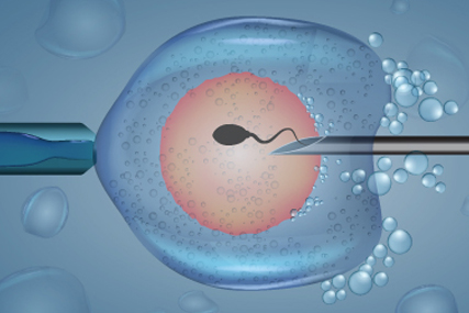 "IVF and Gender Selection: Science, Ethics, and the Truth Behind Choosing Your Baby’s Gender"