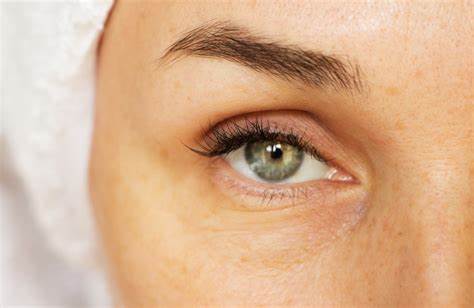 "Six Powerful Tips to Keep Your Eyes Youthful and Healthy for Life"