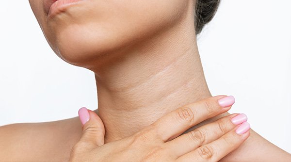 "5 Simple Tricks to Reduce Neck Lines and Wrinkles for a Youthful, Smooth Neck"