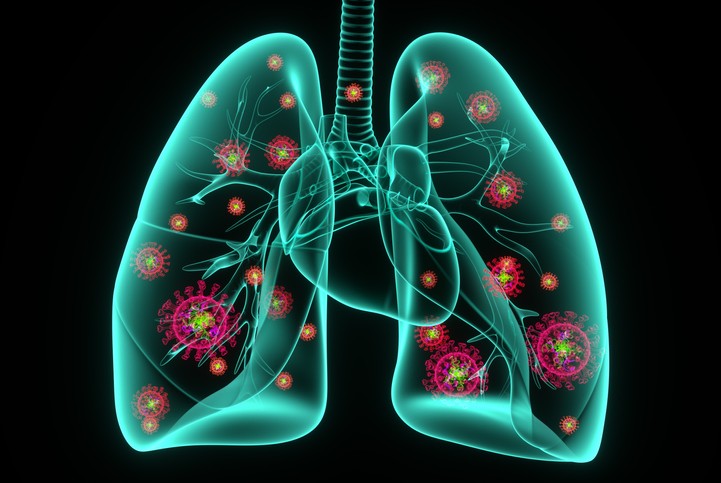 Understand Why Pneumonia Is More Dangerous with Existing Health Issues