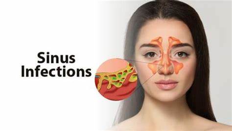 "Say Goodbye to Sinus Trouble: 6 Foods You Must Avoid for Relief and Recovery"