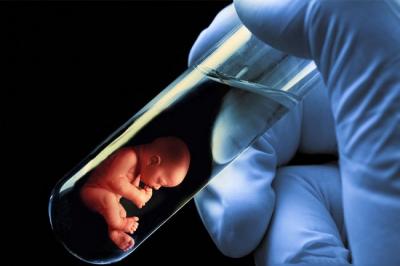 "Test Tube Baby: Understanding the IVF Process, Steps, Benefits, and Challenges"